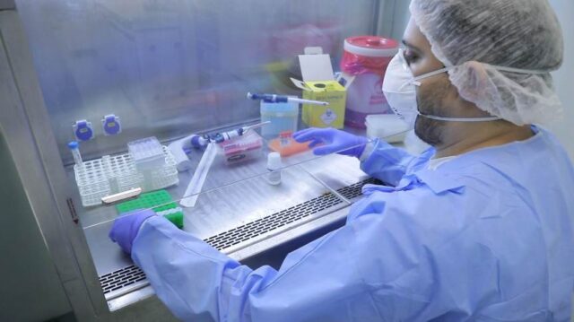 diagnostico_novo_coronavirus_fiocruz_covid_19-25
