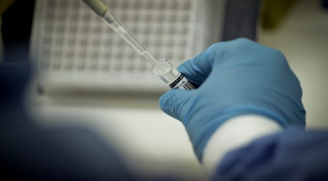 diagnostico_sequenciamento_genomico_covid_19-11