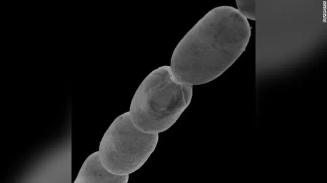 220623110656-04-giant-bacterium-thiomargarita-magnifica-exlarge-169