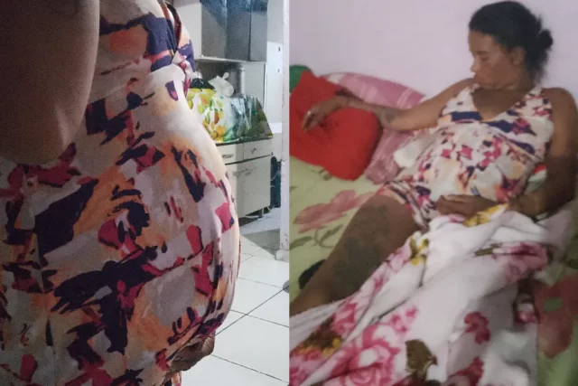 barriga-inchada-juquia