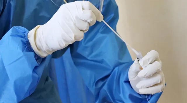 diagnostico_swab_covid_19