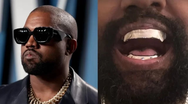 kanye-west-protese-titanio