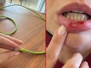 Choque em carregador e perda de memória: empresária do PR estava descalça quando sofreu descarga elétrica de 220 volts