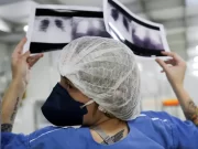 Brasil deve ter 781 mil novos casos de câncer por ano até 2028