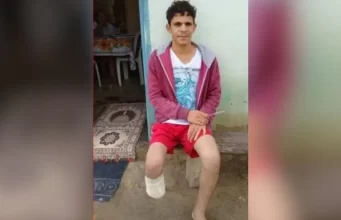 Homem é condenado por amputar o pé para receber seguro milionário na Bahia