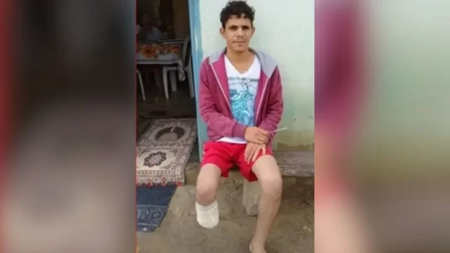 homem-amputa-o-proprio-pe