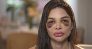 Dentista relata ao ‘Fantástico’ agressões que sofreu do marido, empresário da Faria Lima